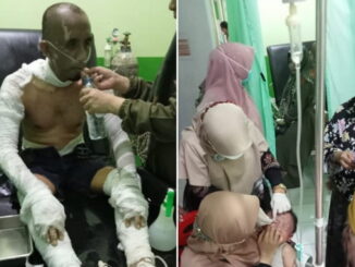 Korban ledakan akibat gas yang bocor di sebuah rumah dalam Kelurahan Pakan Sinayan Payakumbuh Barat.